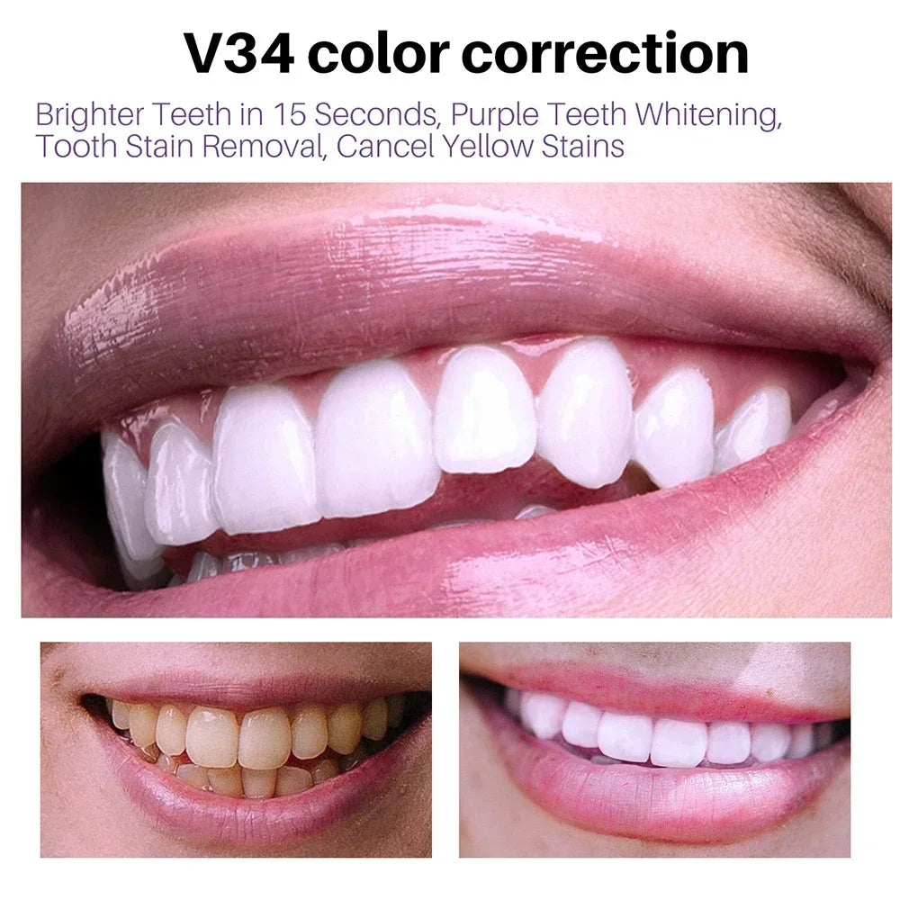 Teeth Cleaning and Whitening Toothpaste